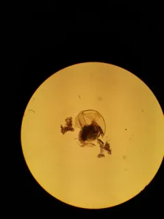 Pleuroxus procurvus thumbnail 2