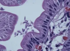 Giardia lamblia thumbnail 2