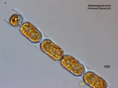 Eupyxidicula turris thumbnail 2