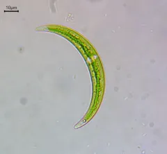 Closterium venus thumbnail 2