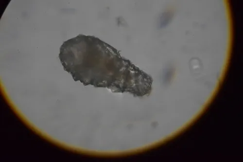 Difflugia oblonga