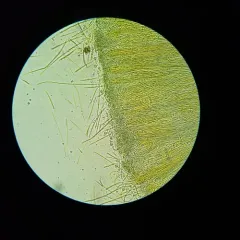 Coccomyces castanopsidis thumbnail 1