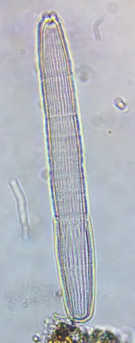 Penium spirostriolatum