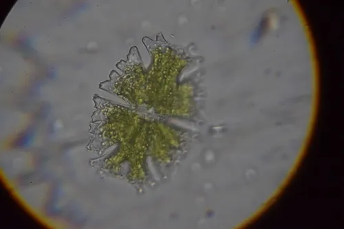 Micrasterias americana