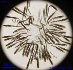 Sporormiella vexans thumbnail 4
