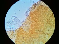 Dialonectria episphaeria thumbnail 1