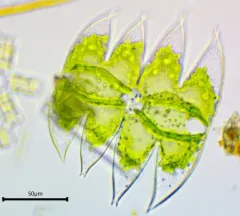 Micrasterias laticeps thumbnail 3