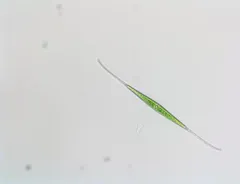 Closterium kuetzingii thumbnail 4