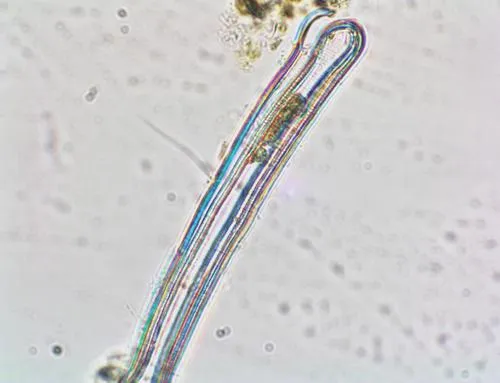 Eunotia formica
