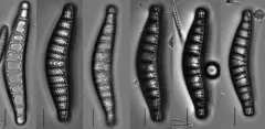 Epithemia alpestris thumbnail 2