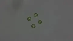 Planktosphaeria gelatinosa thumbnail 3