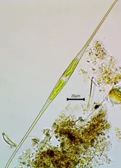 Closterium setaceum thumbnail 2