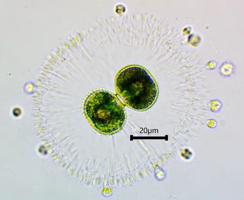 Cosmarium contractum