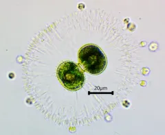 Cosmarium contractum thumbnail 1