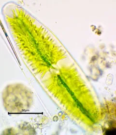 Netrium digitus thumbnail 2
