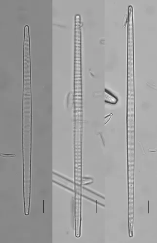 Ulnaria ulna