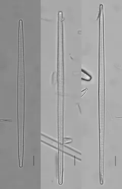 Ulnaria ulna thumbnail 1