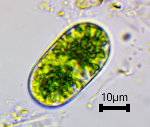 Cylindrocystis brebissonii
