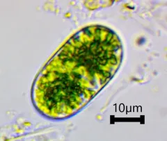 Cylindrocystis brebissonii thumbnail 1