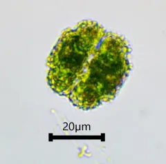 Cosmarium ornatum thumbnail 1