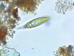 Mallomonas insignis thumbnail 3