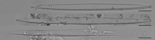 Nitzschia intermedia