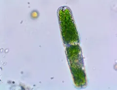Tetmemorus brebissonii thumbnail 1