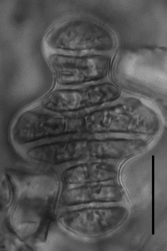 Tetracyclus glans