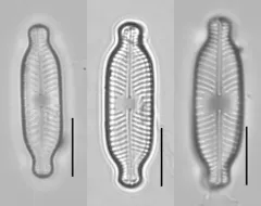 Placoneis paraelginensis thumbnail 2