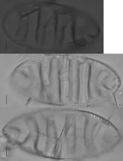 Surirella undulata thumbnail 4