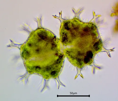 Xanthidium armatum