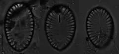 Surirella brebissonii thumbnail 3