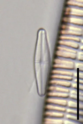 Achnanthidium minutissimum