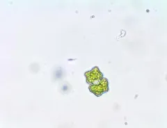 Euastrum binale thumbnail 1