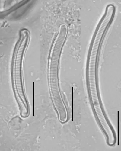 Eunotia nymanniana