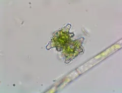Staurastrum margaritaceum thumbnail 3