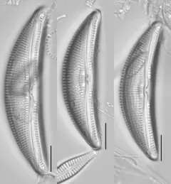 Amphora ovalis thumbnail 4