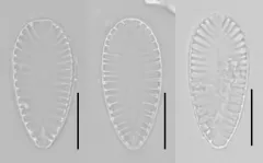 Surirella brebissonii thumbnail 4