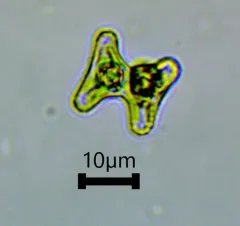 Staurastrum alternans thumbnail 2
