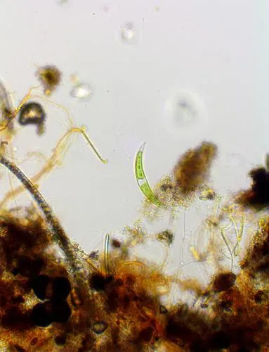 Closterium dianae