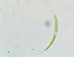 Closterium acutum thumbnail 4