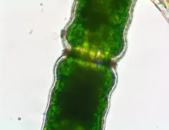Pleurotaenium coronatum thumbnail 3