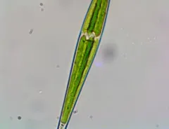 Closterium setaceum thumbnail 4