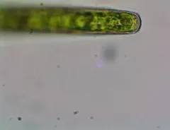 Pleurotaenium trabecula thumbnail 2