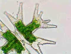 Micrasterias mahabuleshwarensis thumbnail 1