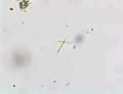 Ankistrodesmus fusiformis thumbnail 4