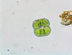 Cosmarium punctulatum thumbnail 4