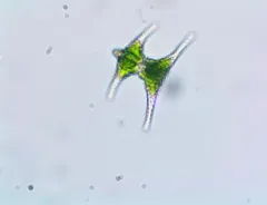 Staurastrum anatinum thumbnail 2