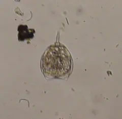 Lecane closterocerca thumbnail 2