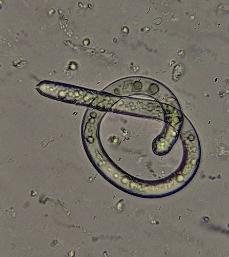 Ophiocytium capitatum